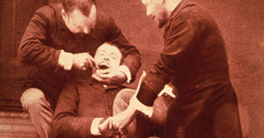 Old photos of tooth extraction